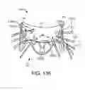 Fig. 41 - Methods and apparatus for delivering a prosthetic valve to a beating heart