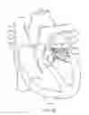 Fig. 44 - Methods and apparatus for delivering a prosthetic valve to a beating heart