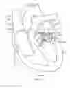 Fig. 46 - Methods and apparatus for delivering a prosthetic valve to a beating heart