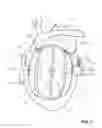 Fig. 02 - ARTIFICIAL HEART