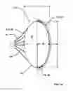 Fig. 06 - ARTIFICIAL HEART