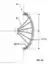Fig. 07 - ARTIFICIAL HEART
