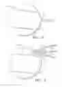 Fig. 04 - Extracellular matrix encasement structures and methods