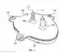 Fig. 02 - Balloon implant device