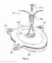 Fig. 07 - Balloon implant device