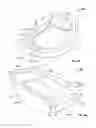 Fig. 07 - Orthopedic augments having recessed pockets