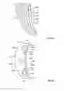 Fig. 08 - Orthopedic augments having recessed pockets