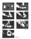 Fig. 04 - Anchoring system for prosthetic and orthotic devices