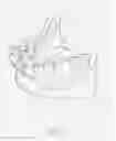 Fig. 07 - Prosthodontic device