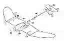 Fig. 01 - Deep stall aircraft landing