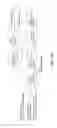 Fig. 14 - TURBO DECODING TECHNIQUES