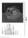 Fig. 05 - METHOD AND SYSTEM FOR IMAGE REPORT INTERACTION FOR MEDICAL IMAGE SOFTWARE