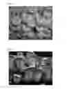 Fig. 04 - Strain of 