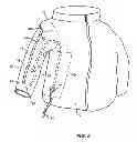 Fig. 06 - Apparel with retractable extensions