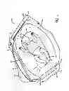 Fig. 02 - Infant sleeping apparatus and child containment system