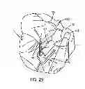 Fig. 19 - Infant sleeping apparatus and child containment system