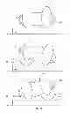 Fig. 09 - Systems, methods, and devices for the treatment of sleep disorders