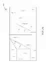 Fig. 72 - Systems, methods, and devices for the treatment of sleep disorders