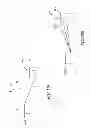 Fig. 82 - Systems, methods, and devices for the treatment of sleep disorders