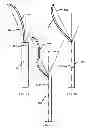 Fig. 05 - Y-Shaped Cleaning Apparatus