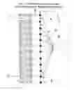 Fig. 02 - Electromagnetic Regolith Excavator