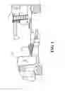 Fig. 02 - Baler accumulation windguard