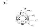 Fig. 04 - Arrangement for a Drug Delivery Device and Method of Assembling the Same