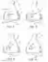 Fig. 02 - MASK AND VENT ASSEMBLY THEREFOR