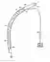 Fig. 01 - Expandable inter vivos tube