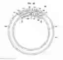 Fig. 06 - Expandable inter vivos tube