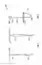 Fig. 02 - Intrauterine Device Remover