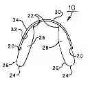 Fig. 01 - TEETH SEPARATING SYSTEM
