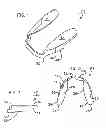 Fig. 02 - TEETH SEPARATING SYSTEM