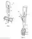 Fig. 02 - TONGUE BRUSH WITH POWERED ROLLER