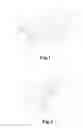Fig. 02 - DRILLER RETAINING DEVICE ABLE TO BE POSITIONED WITH WELL HORIZONTALITY AND VERTICALITY