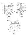 Fig. 04 - Rolling cutter