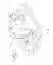 Fig. 02 - Vibrating member attachment structure
