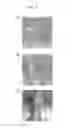 Fig. 09 - Side roller and substrate transport device including the same