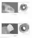 Fig. 08 - High-speed, high-resolution, triangulation-based, 3-D method and system for inspecting manufactured parts and sorting the inspected parts