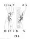 Fig. 02 - PICTURE FRAME HANGER