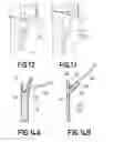 Fig. 07 - PICTURE FRAME HANGER