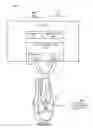 Fig. 08 - Electro-optical radiation collector for arc flash detection