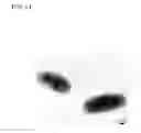 Fig. 09 - Sample supporting member for observing scanning electron microscopic image and method for observing scanning electron microscopic image