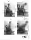 Fig. 02 - AUTO-INFLATABLE CUSHION TO ASSIST MOVEMENT