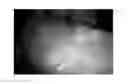 Fig. 01 - OVERLAY AND MOTION COMPENSATION OF STRUCTURES FROM VOLUMETRIC MODALITIES ONTO VIDEO OF AN UNCALIBRATED ENDOSCOPE