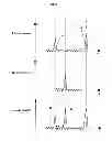 Fig. 05 - Fast measurement of ocular axial length