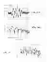Fig. 22 - Dynamic Characterization of Particles With Flow Cytometry