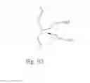 Fig. 06 - Plastic lens