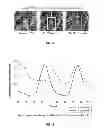 Fig. 02 - Ebeam tomosynthesis for radiation therapy tumor tracking