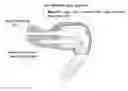 Fig. 01 - Bone transmission earphone